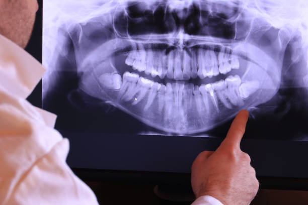 Best Broken Tooth Emergency  in Bloomington, IL